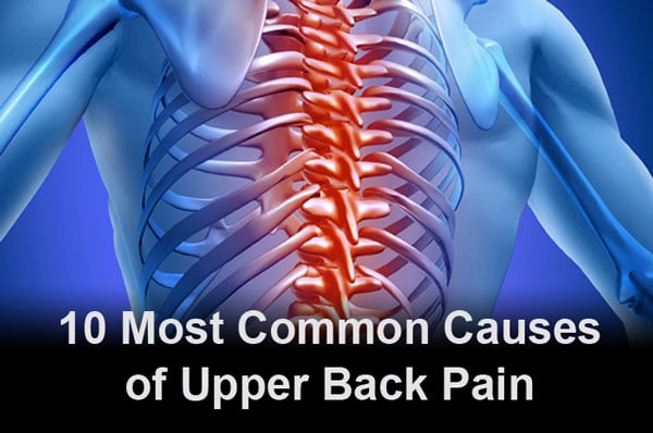 10 Most Common Causes of Upper Back Pain - Picture of Back Spine