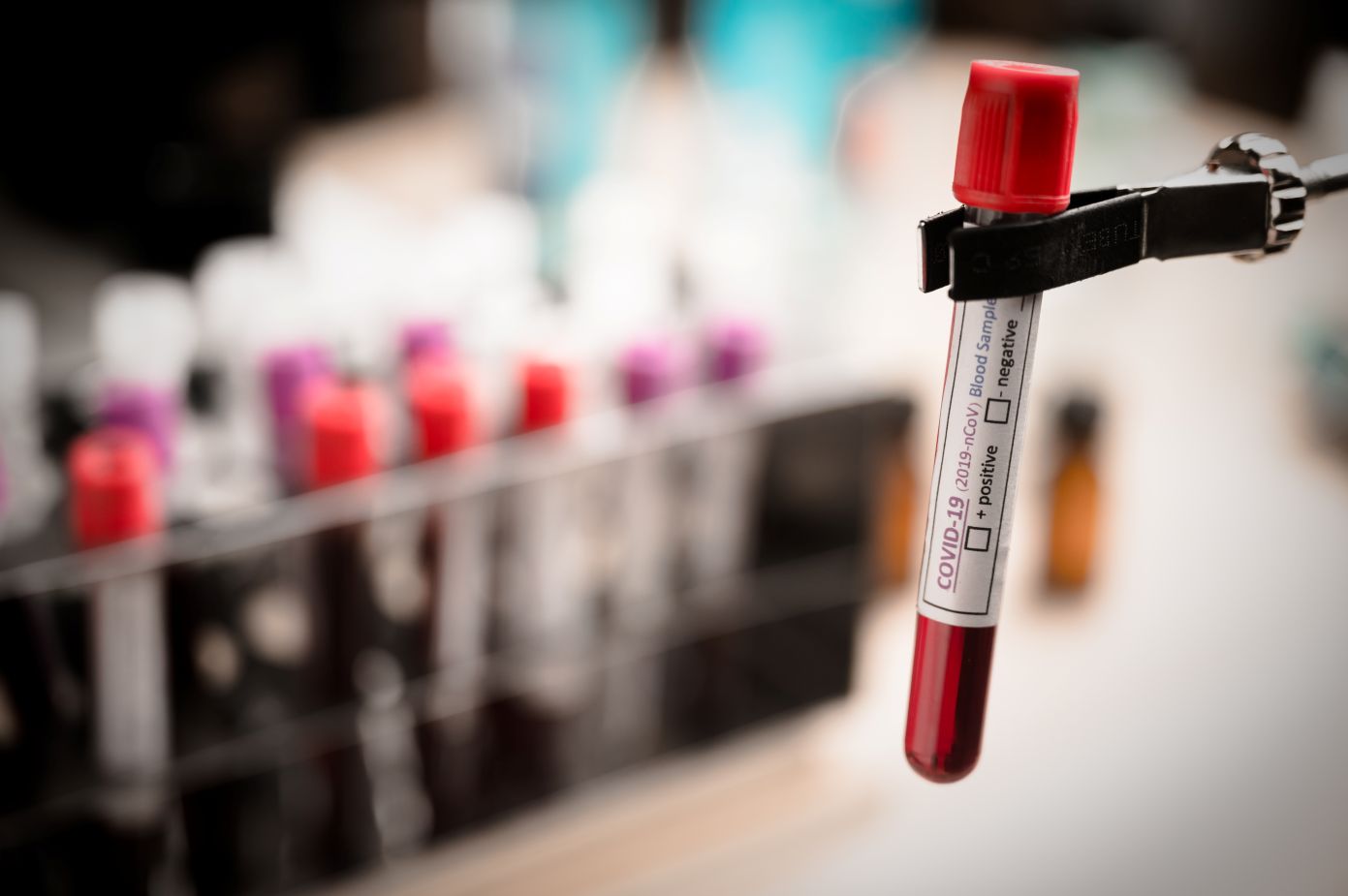 PRP Therapy for Skin and Hair Image of a test tube, featuring A Family Chiropractic Clinic and highlighting PRP therapy for skin and hair rejuvenation.