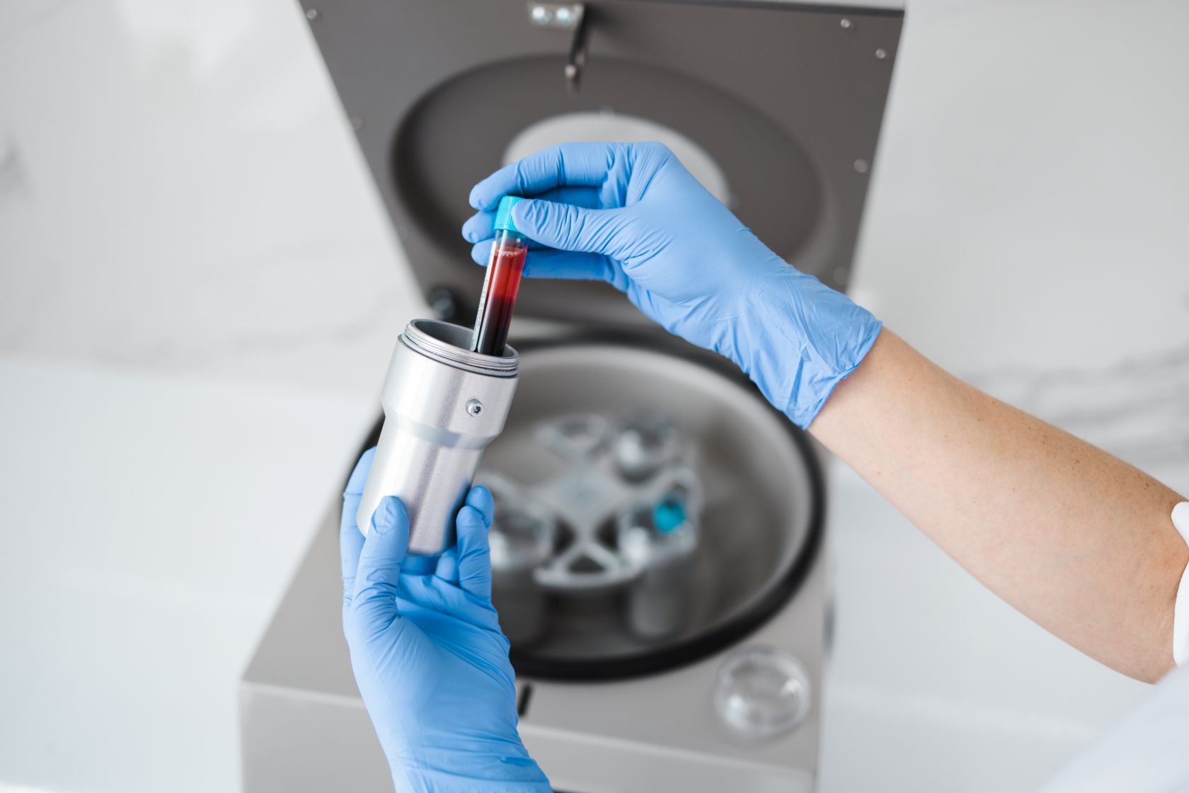 Platelet Rich Plasma Therapy for Face and Hair Image of a test tube, featuring A Family Chiropractic Clinic and highlighting Platelet Rich Plasma (PRP) Therapy for face and hair rejuvenation.
